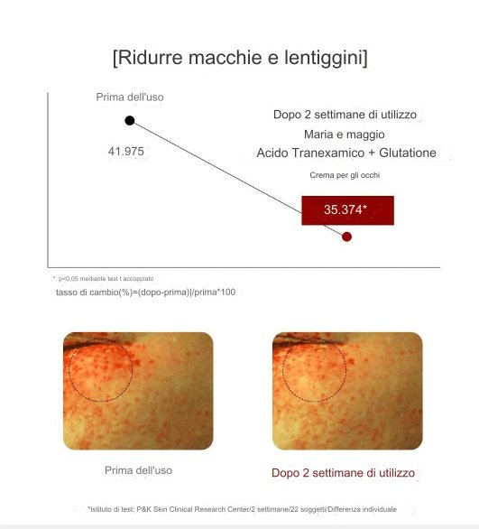 CONTORNO OCCHI PER OCCHIAIA E CREMA PER MELASMA - ANTIAGE - SKIN CARE